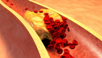 colesterol, grasimi in sange